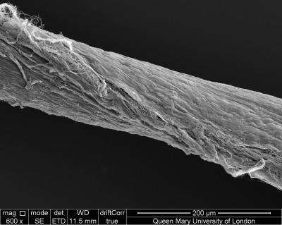 Helix Structure in Tendon
