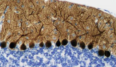 Cerebellum Sample from a Healthy Mouse