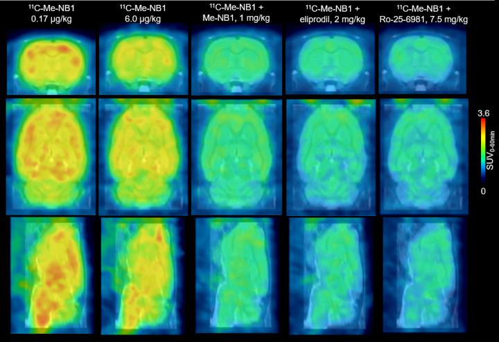 Rat Brain <sup>11</sup>C-Me-NB1 PET Images (0-60 min) Superimposed on an MRI Template