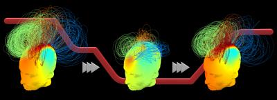 Brain Networks during the Transition to Unconsciousness