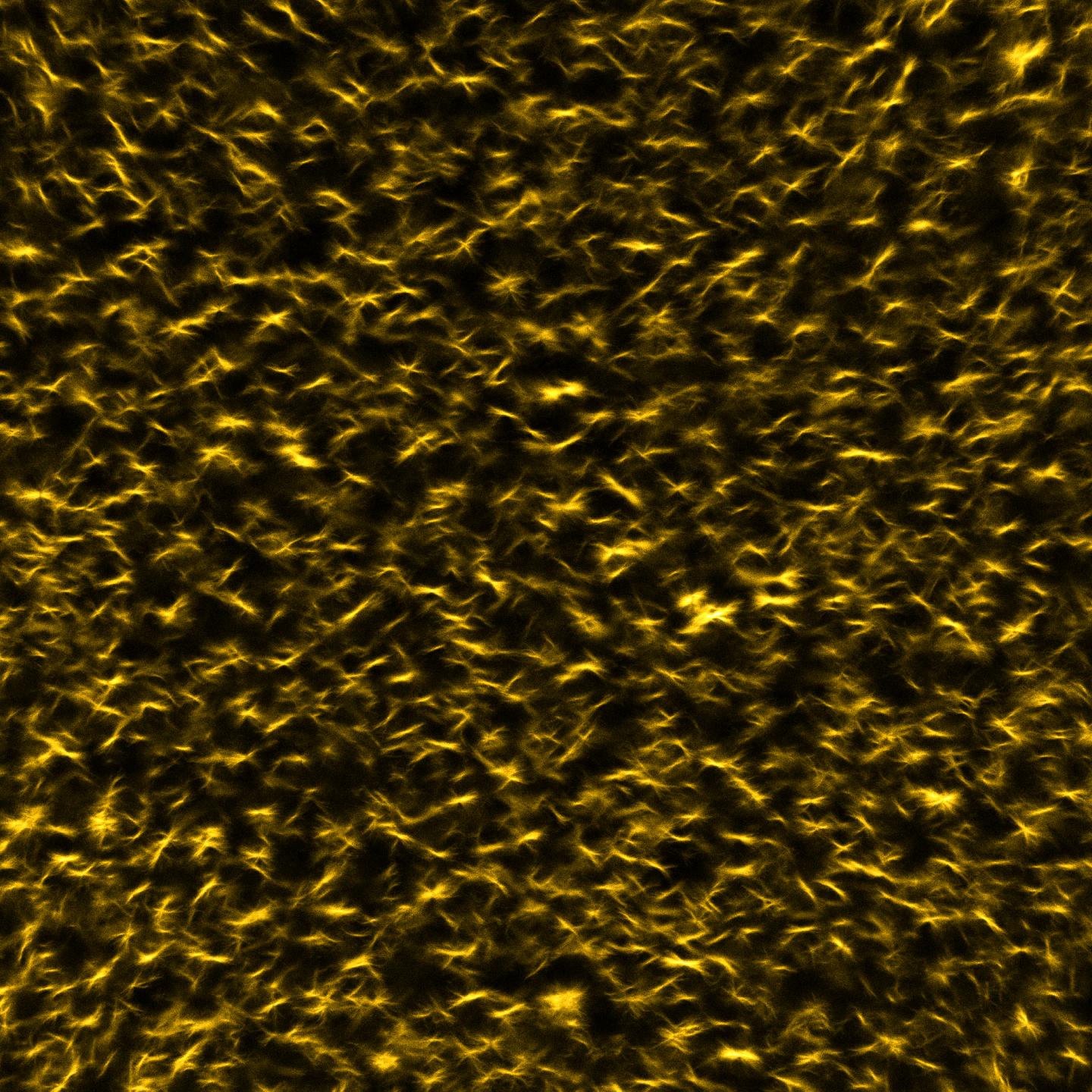 Temporary Gels from Fmoc Tripeptides