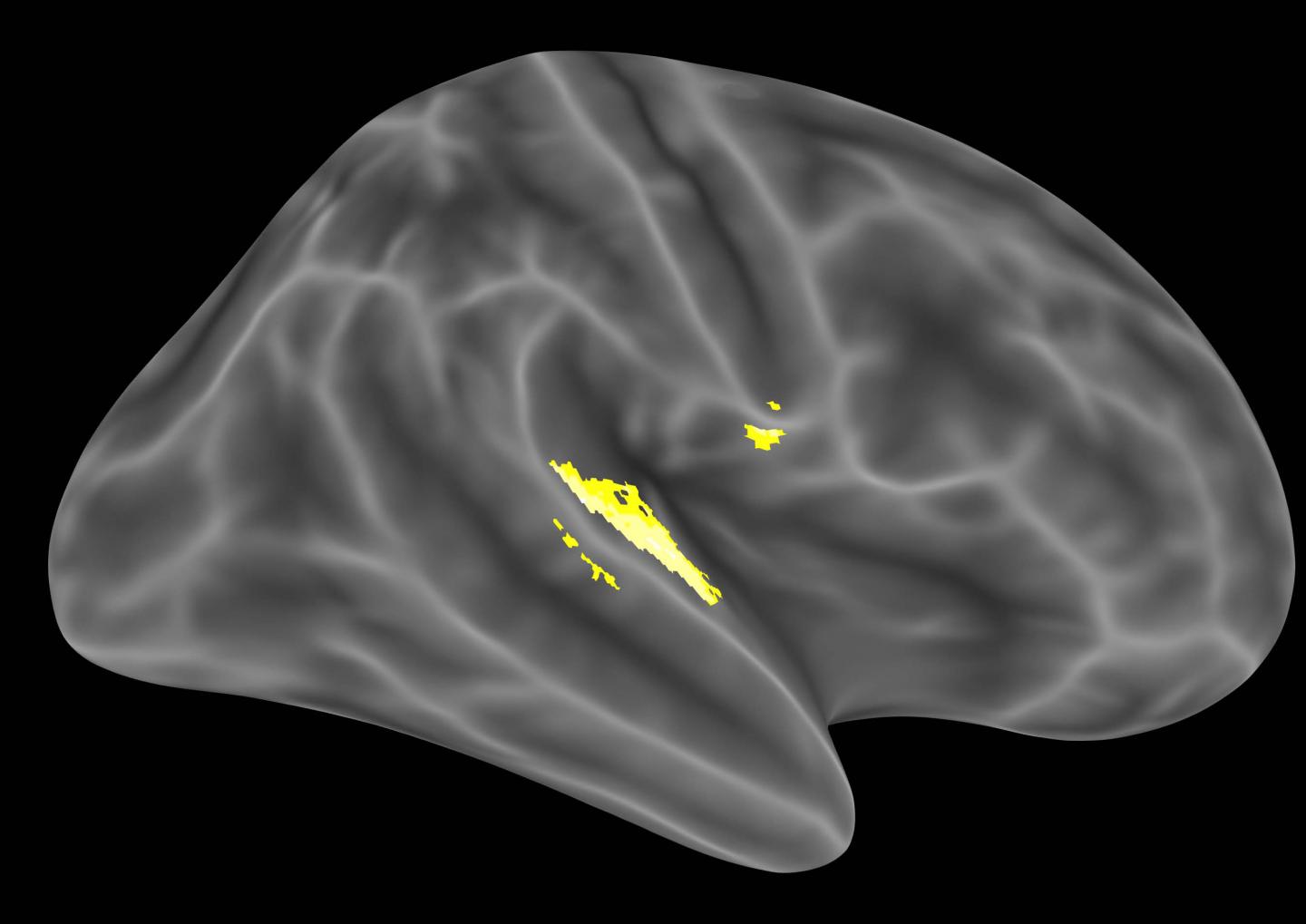 How Perception, Association and Belief Drive Hallucinations