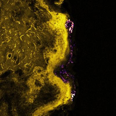 Overlay of the Confocal/Multiphoton Image of the Excised Human Skin