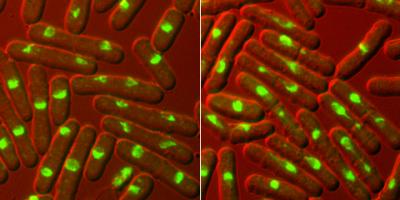 Aurora Yeast Combined