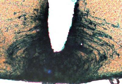 Injection of Active p70 S6K1 Virus