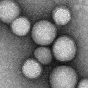 TEM Neutrophil Nanosponges