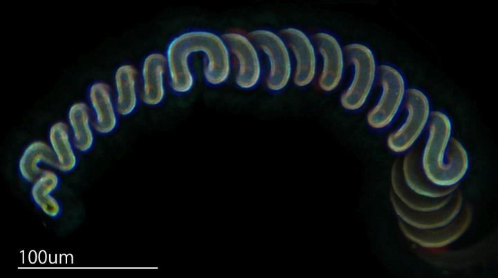The Female Spermathecal Duct of Thistle Tortoise Beetles