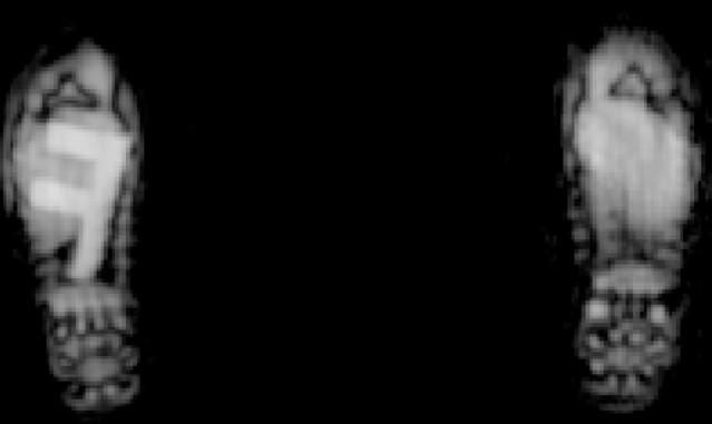 Shoe Scanner Technology