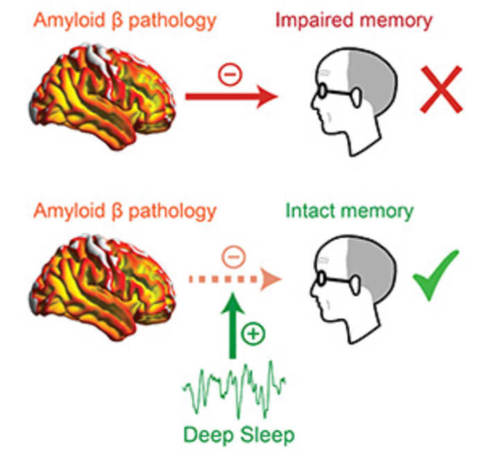 Deep Sleep May Mitigate Alzheimers Memory Lo Eurekalert