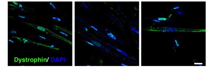 DMD Muscle Cells