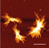 Huntingtin Protein Aggregates
