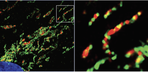 Mitochondria being decorated with eat-me signals