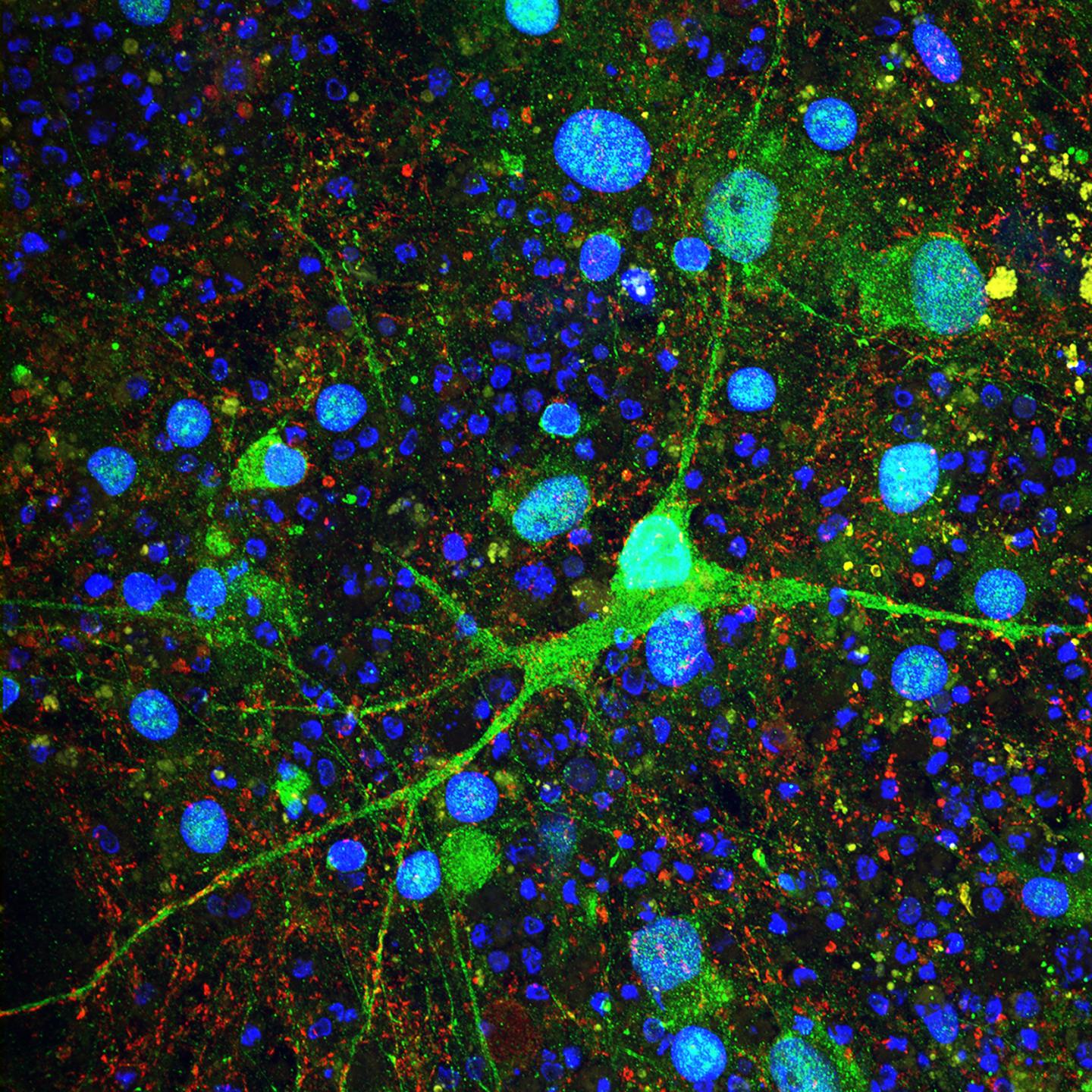 Purkinje Cells Model Tuberous Sclerosis Complex