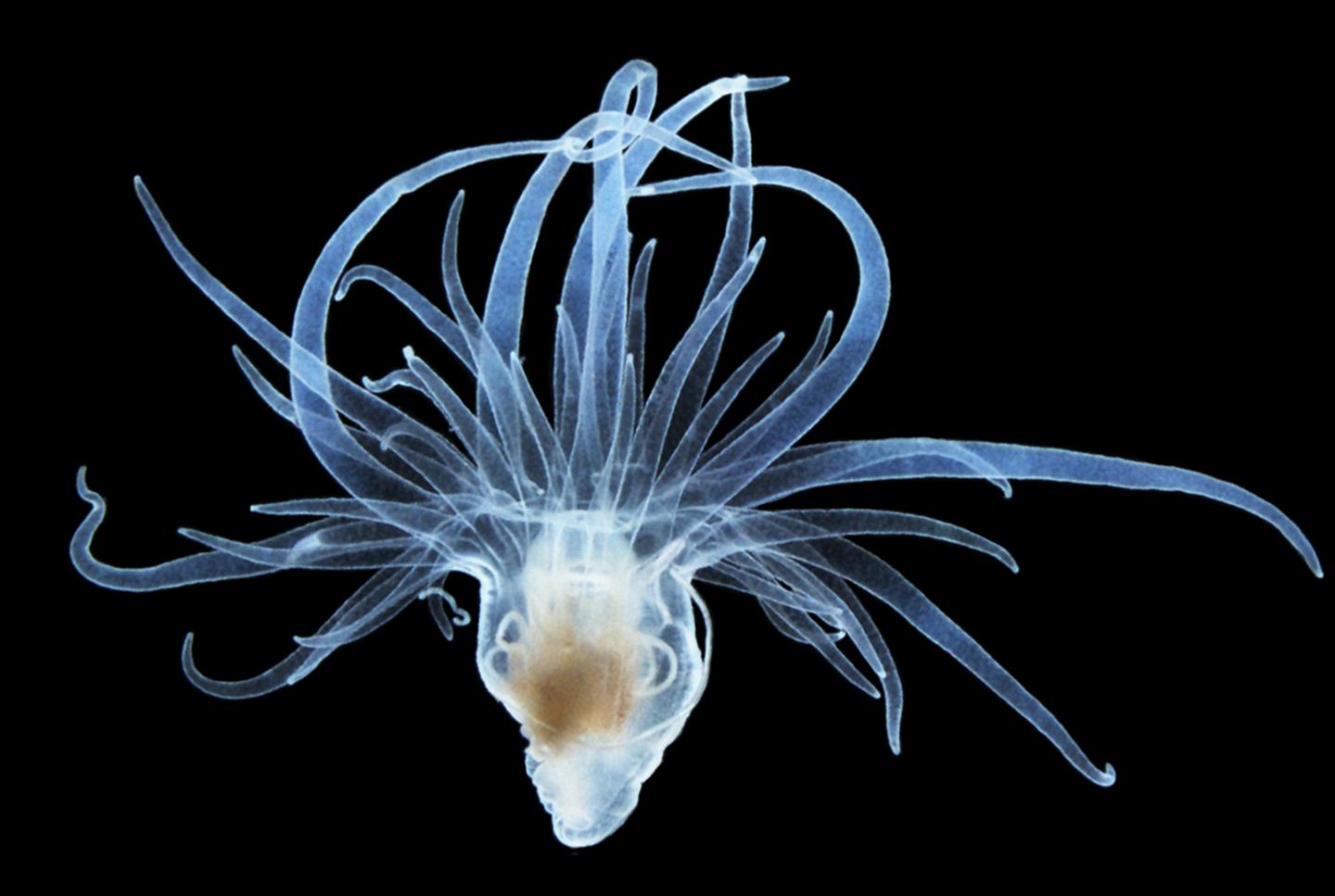 Aposymbiotic <em>Aiptasia</em> (1 of 3)