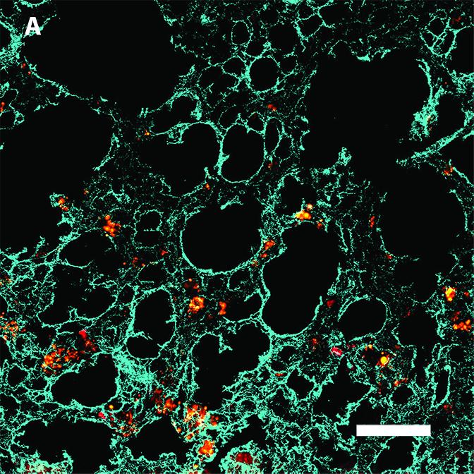 Stiffness Helps Stem Cells Sense and Snuff Metastatic Cancer (3 of 3)