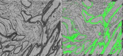 Myelinated Fibers in Mouse Cerebral Cortex