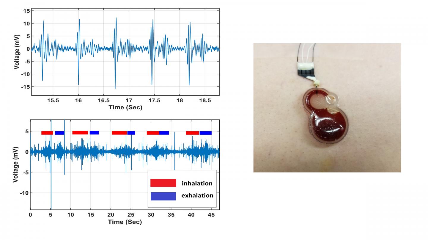 Wearable sensor for cardiorespiratory monitoring