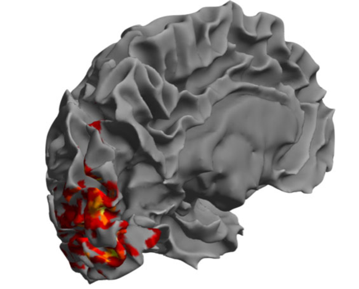 Brain showing visual responses