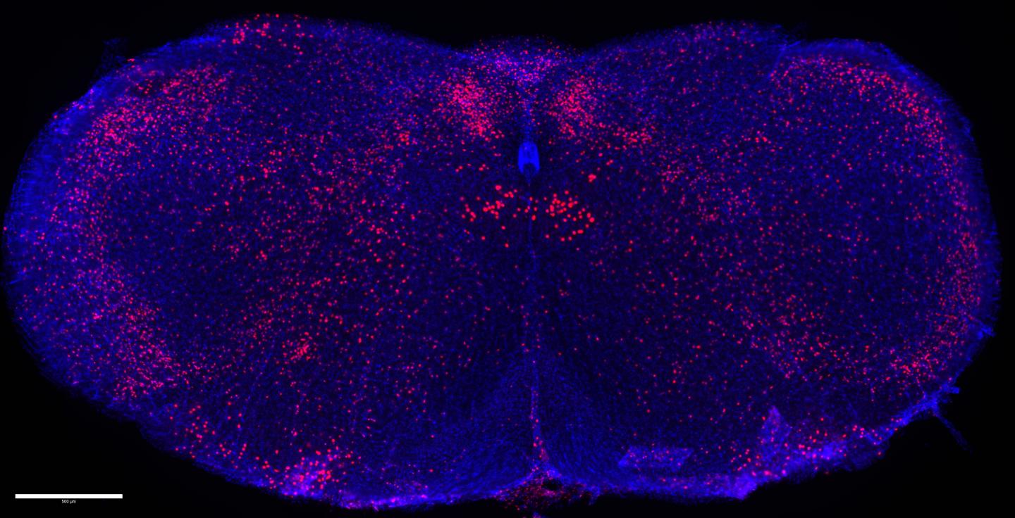 cNST brain region