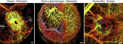 Seeing inside a Tumor