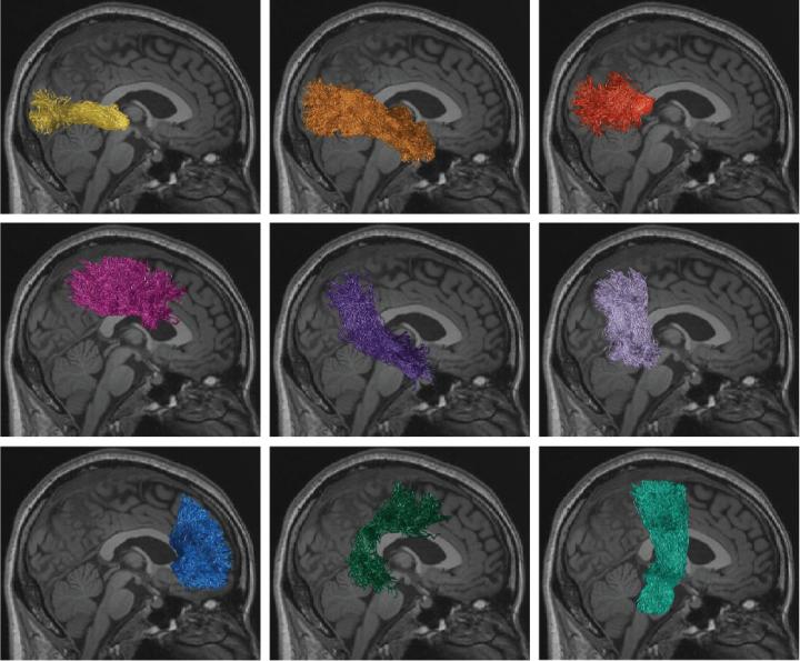 White Matter Anatomy Segmentation