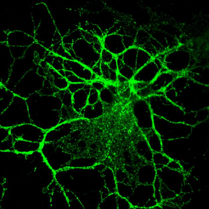 Myelin-producing brain cell with PLP protein