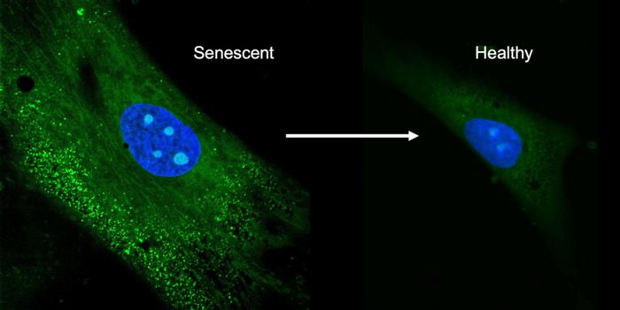 Stem cell before and after new drug