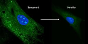 Stem cell before and after new drug