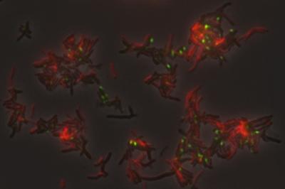 Actinobacteria-TM7