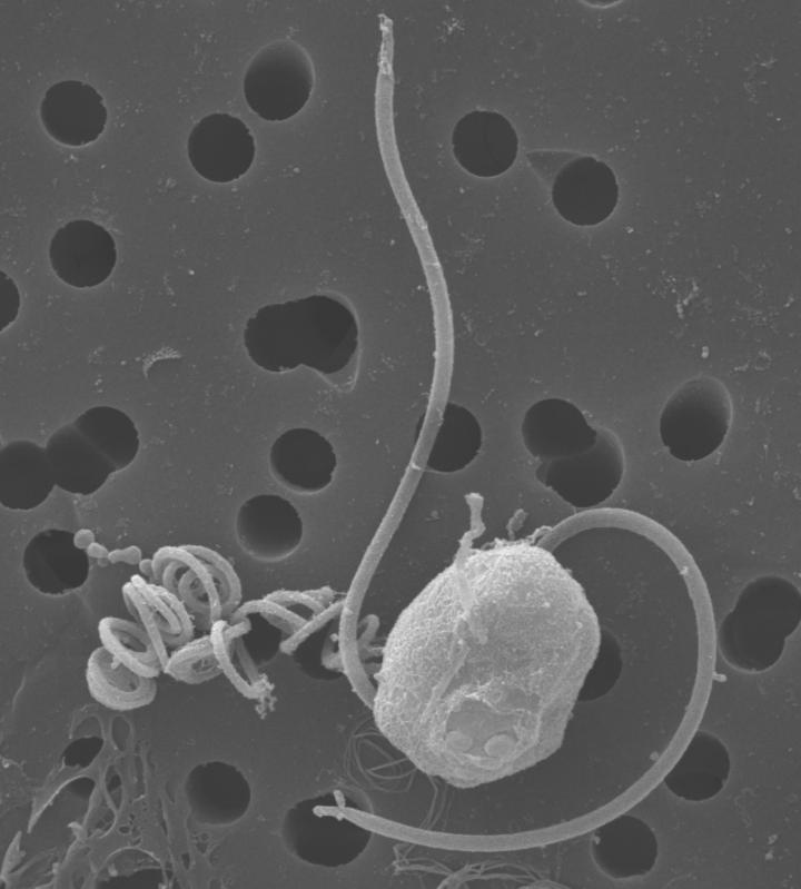 <I>Chrysochromulina</I> (1 of 2)