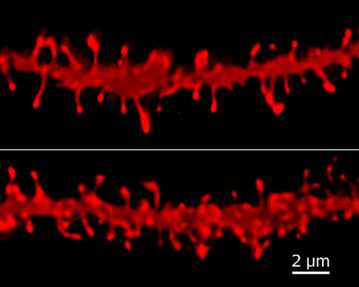 Alzheimer's Drug Repairs Brain Damage After Alcohol Binges In Rodents