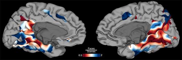 Map of the Brain Surface Showing Regions