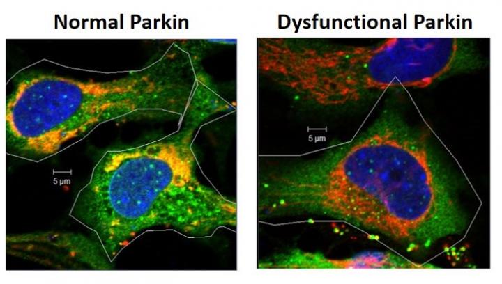 Role of Parkin Gene in Eye Lens Free Radical Formation and Cell Survival