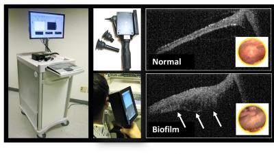 Non-Invasive Middle Ear Imaging