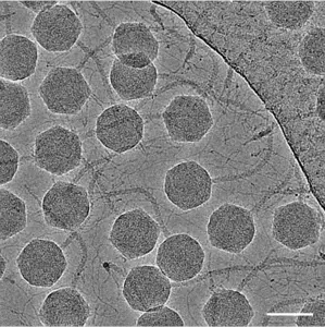 An electron micrograph of the DT57C bacteriophage