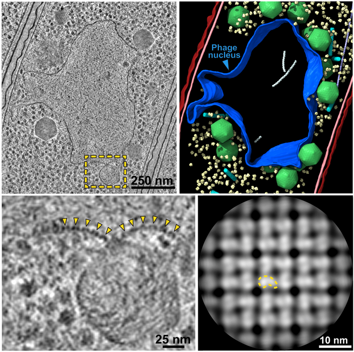 Jumbo phage-infected bacterial cell