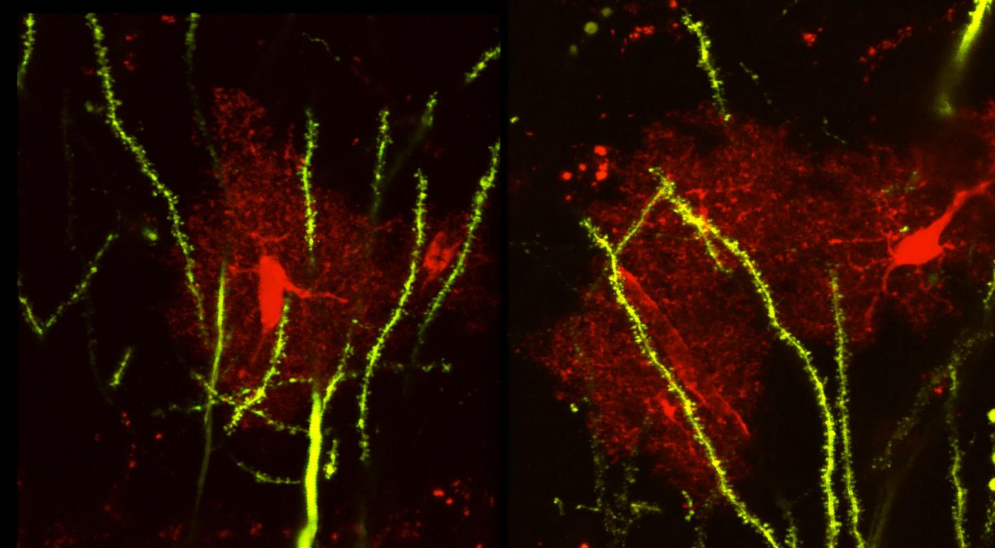 Astrocytes and neurons