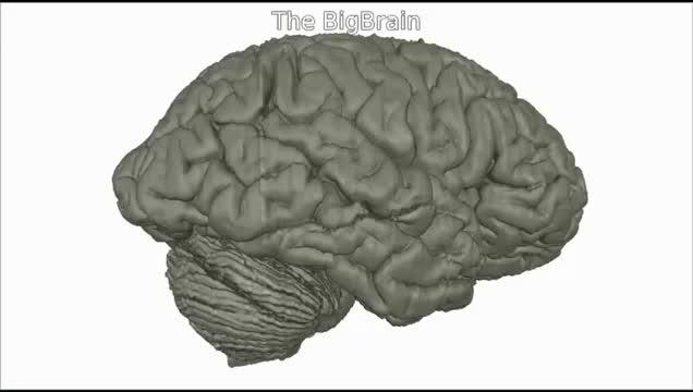 Available Now in 3-D: An Ultra-High Resolution Brain (5 of 5)