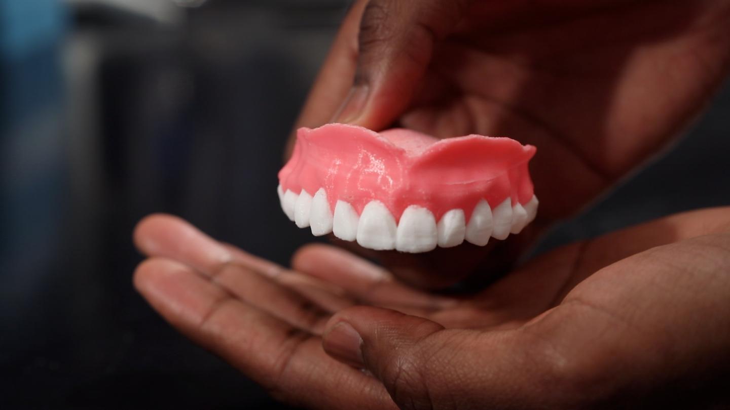 3-D Printed Dentures Filled with Antifungal Medication