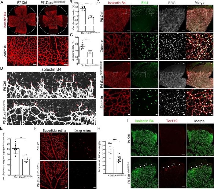 Loss of Emc1 in mouse endothelial cells results in retinal vascular defects