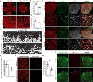 Loss of Emc1 in mouse endothelial cells results in retinal vascular defects