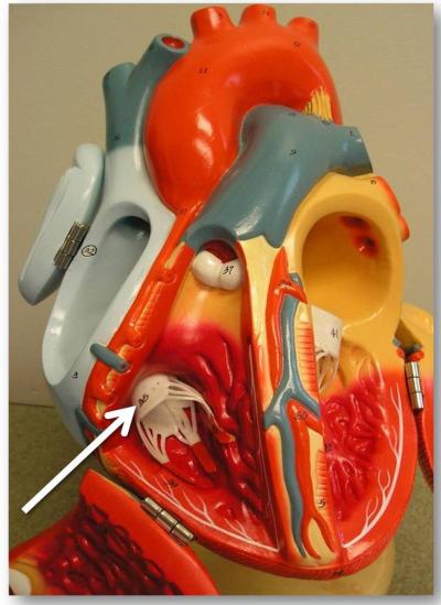 Tricuspid Heart Valve