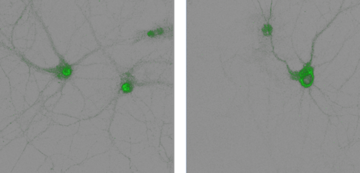 PDE4D5 in the nucleus of hippocampal neurons