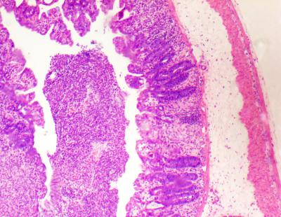 Biopsy from a Mouse Intestine