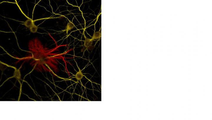 Glial Cell Line-Derived Neurotrophic Factor