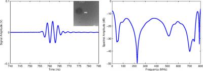 Listening to Blood Cells: Simple Test Could Use Sound Waves for Diagnosing Blood-Related Diseases