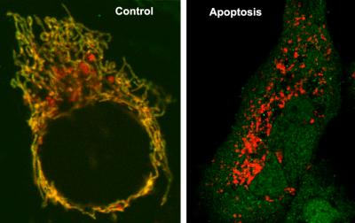 Bak Protein Sets Stressed Cells on Suicide Path, Researchers Show