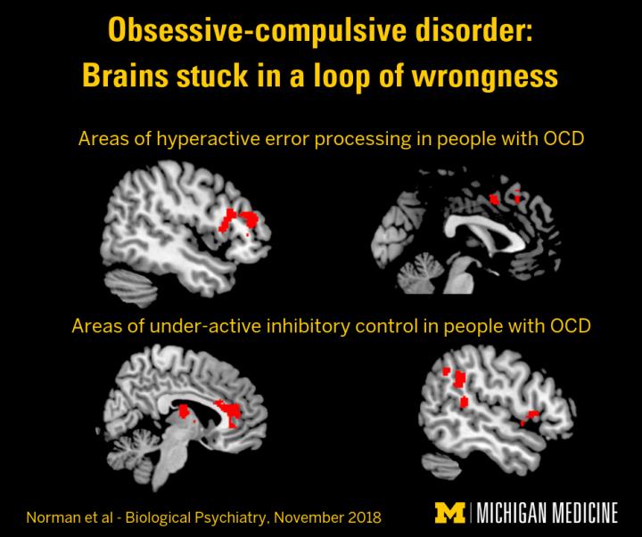 Brain Regions Involved in OCD