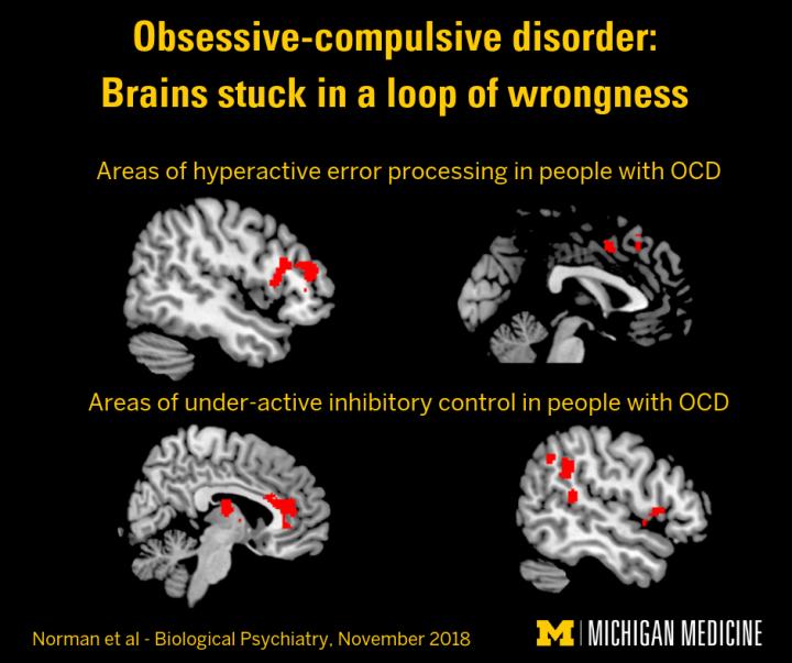 stuck-in-a-loop-of-wrongness-brain-study-sho-eurekalert