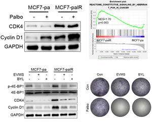 Targeting PI3K/mTOR pathway decreases Cyclin D1/CDK4 protein translation and restores CDK4/6 inhibitors sensitivity in breast cancer.